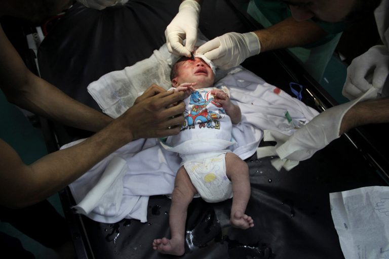Palestinian doctors treats an injured baby, following an Israeli airstrike on a building, at the treatment room of al Najar hospital in Rafah in the southern Gaza Strip, Thursday, Aug. 21, 2014. (AP Photo/Hatem Ali)