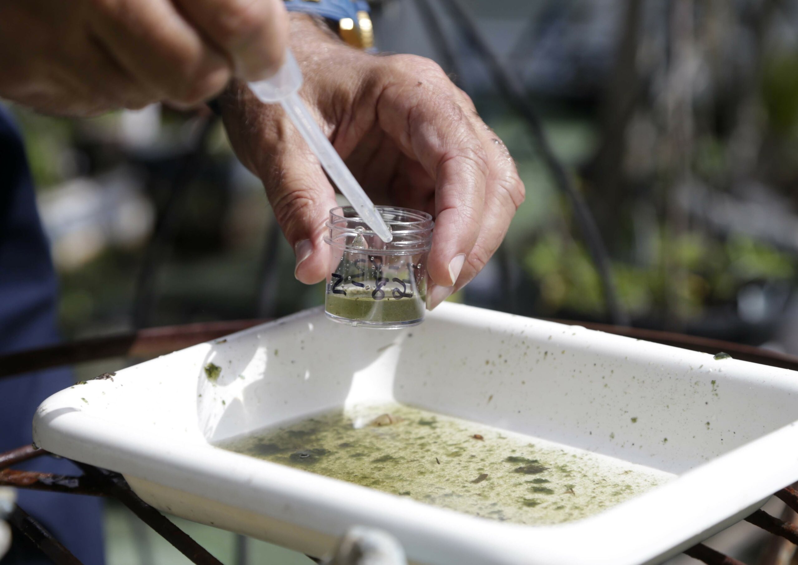 Federal scientists start testing Zika vaccine