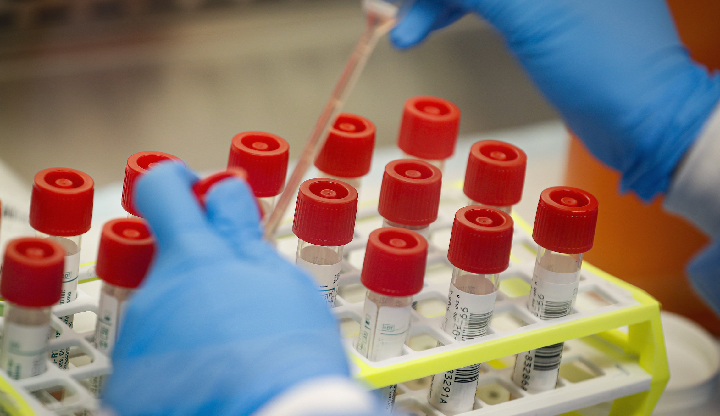 Democrats: Trump lacks ‘serious plan’ to increase coronavirus testing