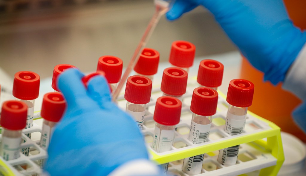 Democrats: Trump lacks ‘serious plan’ to increase coronavirus testing