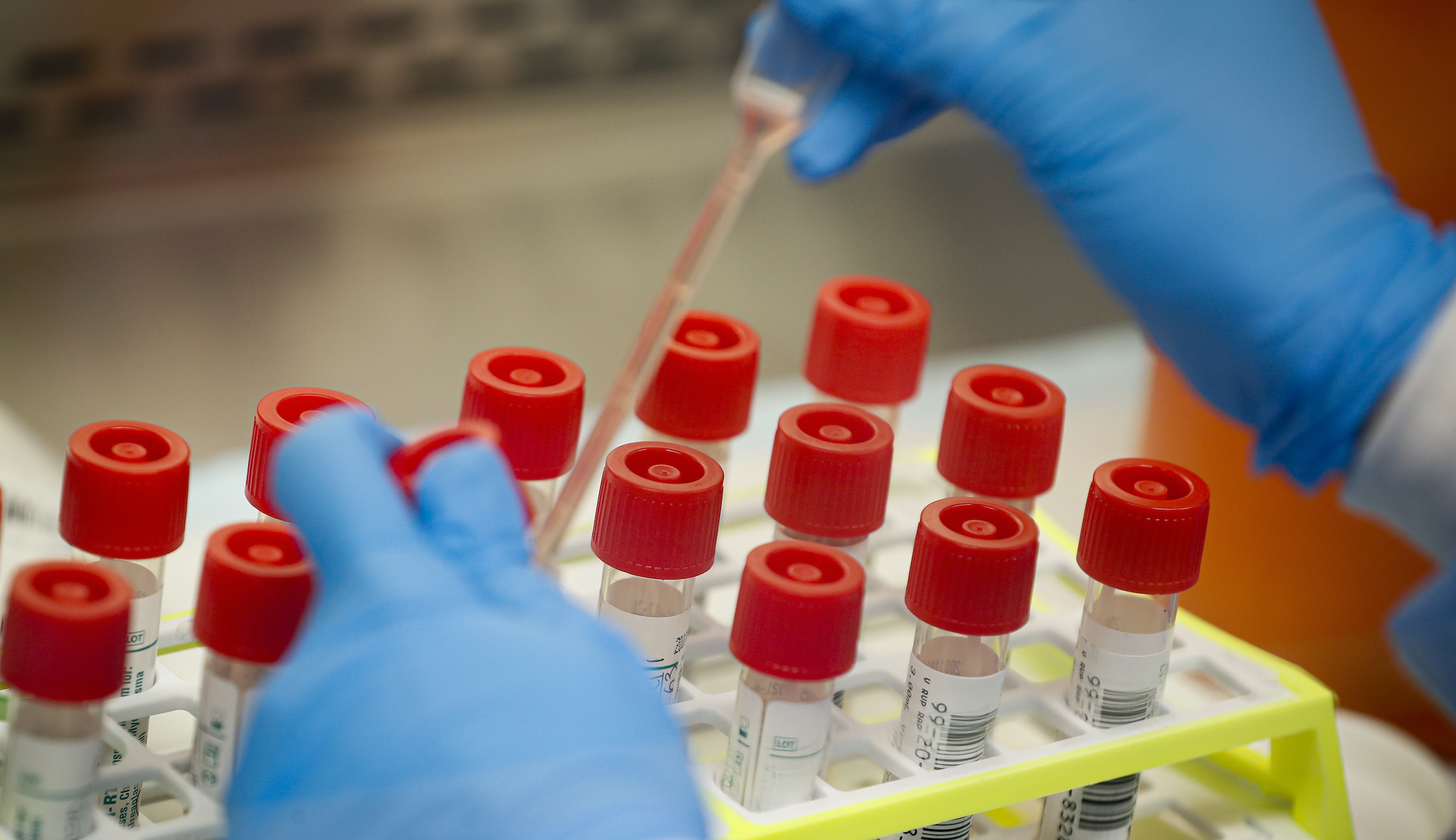 US surpasses 6M coronavirus cases