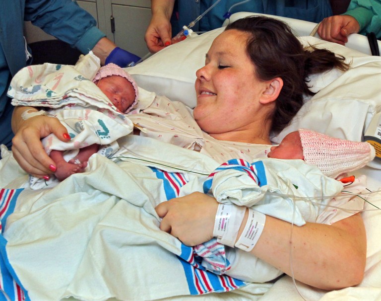 Sarah Thistlethwaite holds her twin daughters, Jenna and Jillian, after her delivery of the monoamniotic twin girls at Akron General Hospital in Akron, Ohio. The identical twin girls shared the same amniotic sac and placenta, which doctors say occurs in about one of every 10,000 pregnancies. The Thistlethwaites say the girls are making progress toward going home from the hospital. A photo showing the girls holding hands taken shortly after birth May 9 at Akron General Medical Center has been widely seen on social media, in newspapers and on national TV. (AP Photo/Akron Beacon Journal, Ed Suba Jr.)