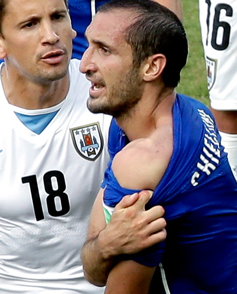 Italy's Giorgio Chiellini displays his shoulder showing apparent teeth marks after colliding with the mouth of Uruguay's Luis Suarez during the group D World Cup soccer match between Italy and Uruguay at the Arena das Dunas in Natal, Brazil, Tuesday, June 24, 2014. (AP Photo/Hassan Ammar)