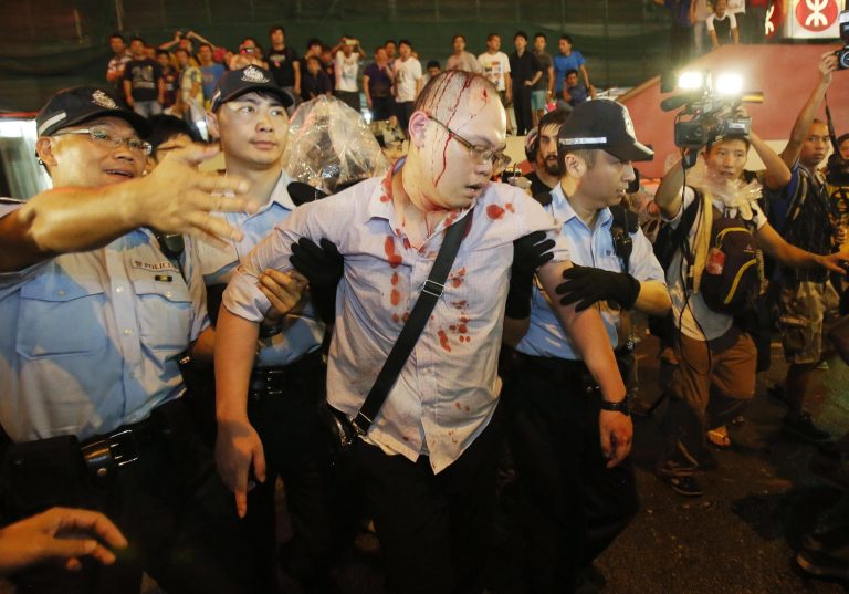 Police take an injured man from the confrontation of pro-democracy student protesters and angry local residents in Mong Kok, Hong Kong, Friday, Oct. 3, 2014. Pushing and yelling, hundreds of Hong Kong residents tried to force pro-democracy activists from the streets they were occupying Friday as tensions rose in the weeklong protests that have shut down parts of the city. (AP Photo/Wally Santana)
