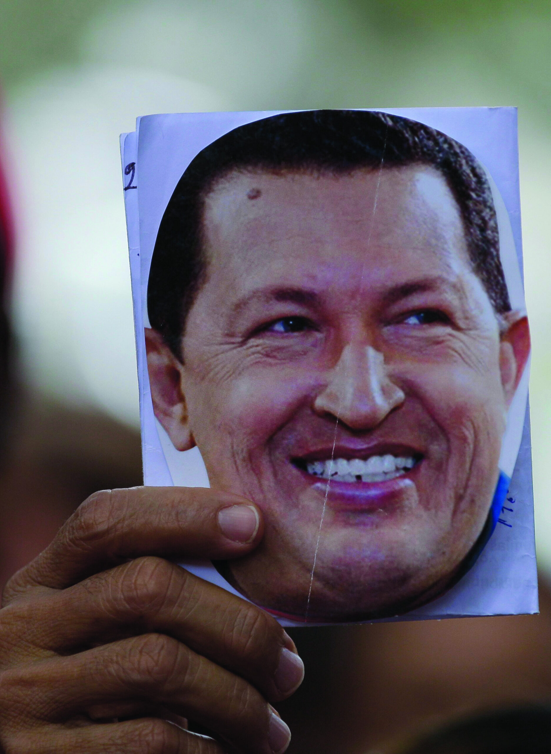 Chavez faces new cancer battle, another operation