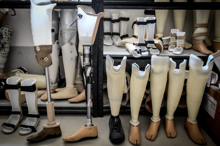 A collection of prosthetic limbs, prosthetic legs, and AFO (Ankle-Foot Orthopedic) at PUSPADI Bali on October 4, 2013 in Denpasar, Bali, Indonesia. (Photo by Agung Parameswara/Getty Images)