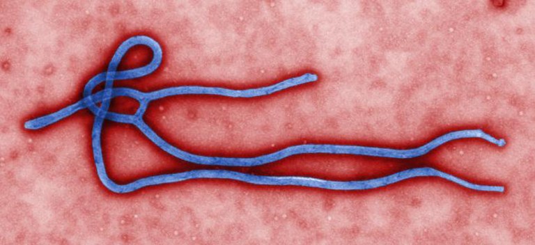 This undated file image by the Centers for Disease Control shows an ebola virus.