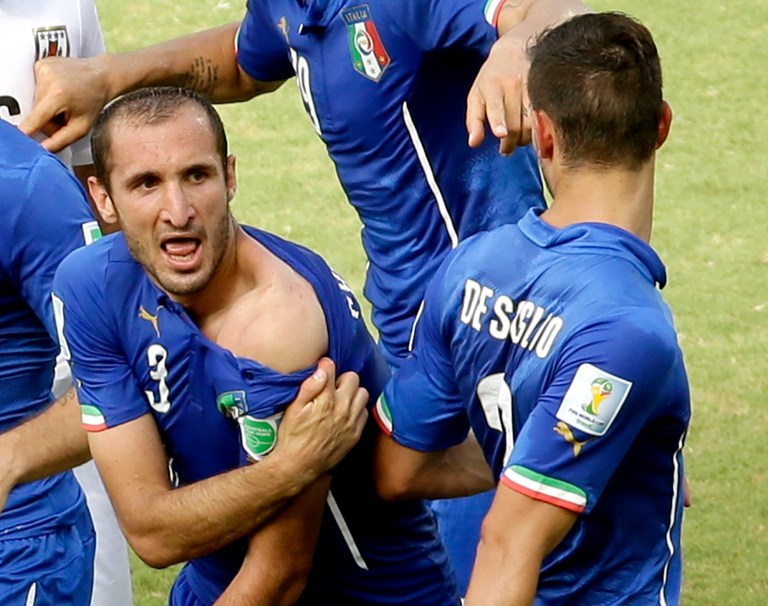 Italy's Giorgio Chiellini displays his shoulder showing apparent teeth marks after colliding with the mouth of Uruguay's Luis Suarez during the group D World Cup soccer match between Italy and Uruguay at the Arena das Dunas in Natal, Brazil, Tuesday, June 24, 2014. (AP Photo/Hassan Ammar)