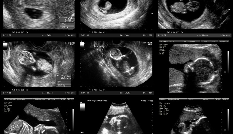 For 75 years the field of human embryology has documented when a human life begins in the Carnegie Stages of Early Human Embryonic Development and the Carnegie Chart. (iStock)
