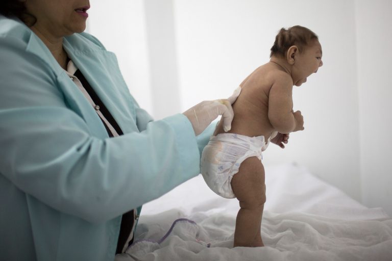 Health officials says Zika causes a birth defect called microcephaly as well as similar birth defects. (AP Photo/Felipe Dana, File)