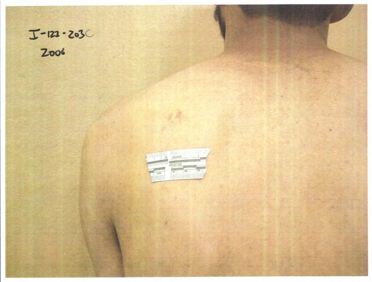 The images were published following a 2004 lawsuit from the American Civil Liberties Union. (Courtesy of the Pentagon)