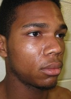 Accused hatchet man enlisted help to dispose of body