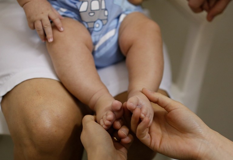 Of the nine women confirmed to have the Zika virus, two lost their pregnancy, two actively terminated them and three gave birth. Two others are continuing with their pregnancies. (AP Photo)