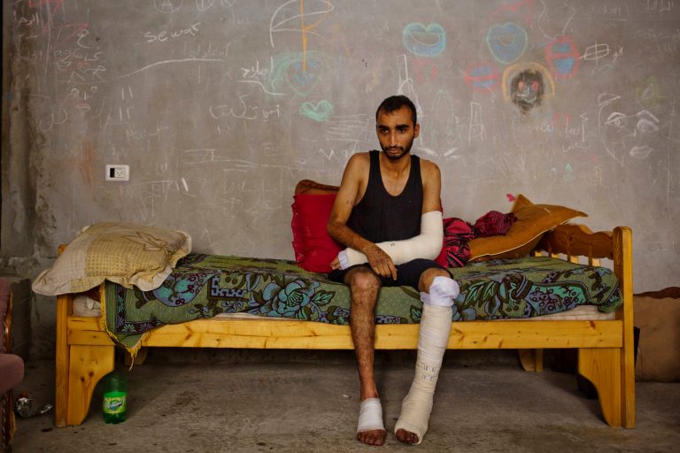 In this photo made on Wednesday, Aug 6, 2014, Shaker Abu Shawqah, wounded during a shelling in Nusseirat refugee camp in his legs and arm, rests in a basement of a building in Gaza City. More than 9,000 Palestinians, the majority of them civilians and nearly a third among them children, have been wounded in the month long Gaza war. (AP Photo/Dusan Vranic)