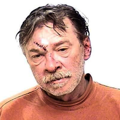 Police: Madonna’s brother resists arrest, is hurt
