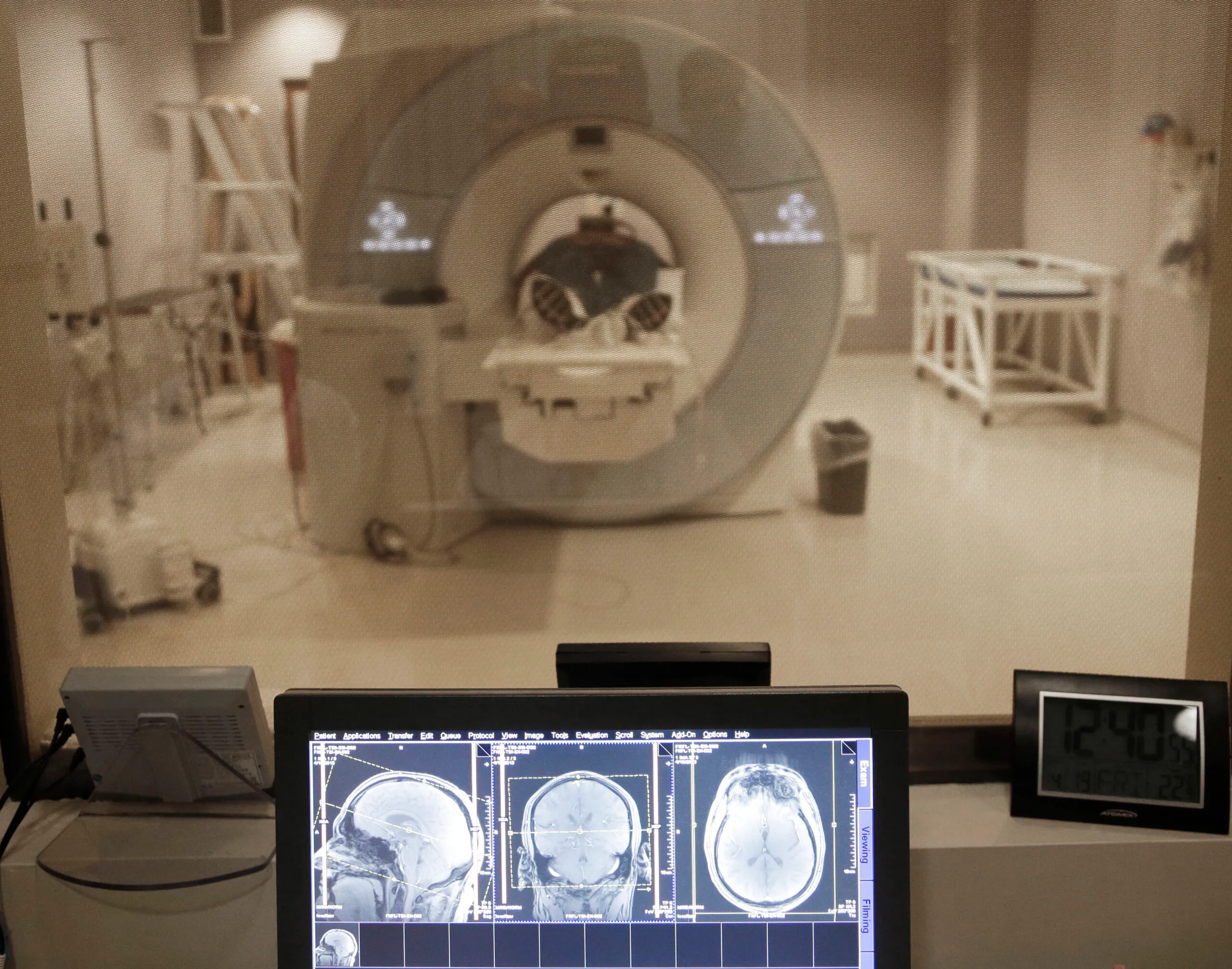 Dems: NFL improperly influenced brain research