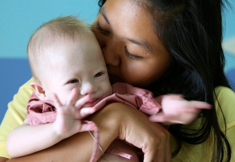 Pattaramon Chanbua, right, kisses her baby boy Gammy at a hospital in Chonburi province, southeastern Thailand Sunday, Aug. 3, 2014. The Australian government is consulting Thai authorities after news emerged that Gammy, a baby with Downs Syndrome was abandoned with Chanbua, his surrogate mother, in Thailand by his Australian parents, according to local media. (AP Photo/Apichart Weerawong)