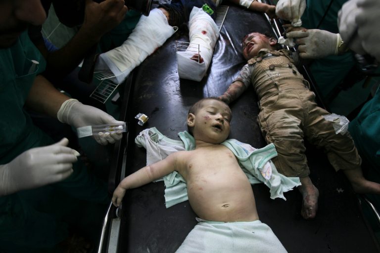 Palestinian children wounded in Israeli shelling are treated in a hospital in Rafah in the southern Gaza Strip, Friday, Aug. 1, 2014. (AP Photo/Eyad Baba)