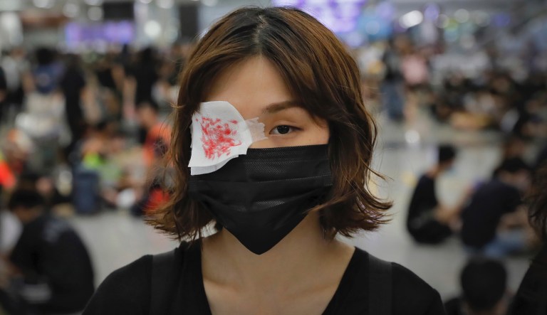 A protester wears an eyepatch during a sit-in protest at the Hong Kong International Airport in Hong Kong, Monday, Aug. 12, 2019. One of the world's busiest airports canceled all flights after thousands of Hong Kong pro-democracy protesters crowded into the main terminal Monday afternoon.