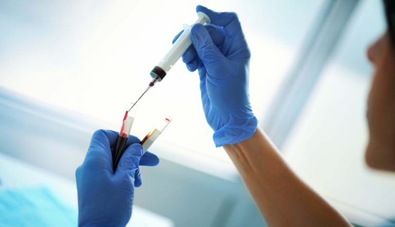 Closeup of a nurse filling vials with a patient's blood samples.