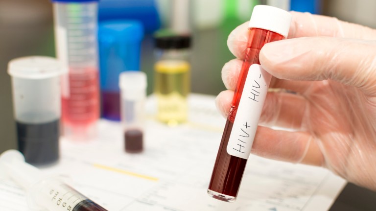 With HIV, politics let disease go viral. Don’t let it happen again