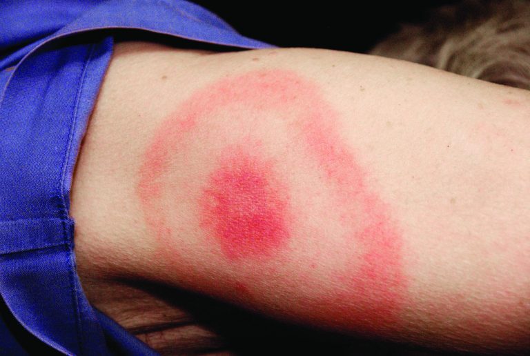 A Nonspecific Diagnosis