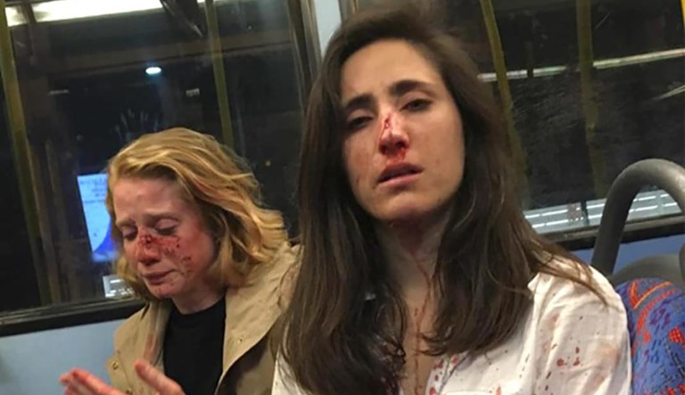 Why the attack on lesbian couple in London is a big deal