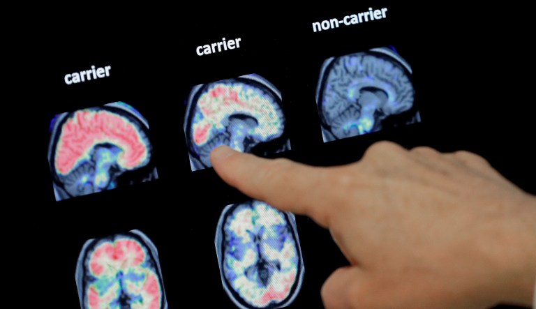 FDA panel criticizes agency approval of controversial $56,000 Alzheimer’s drug