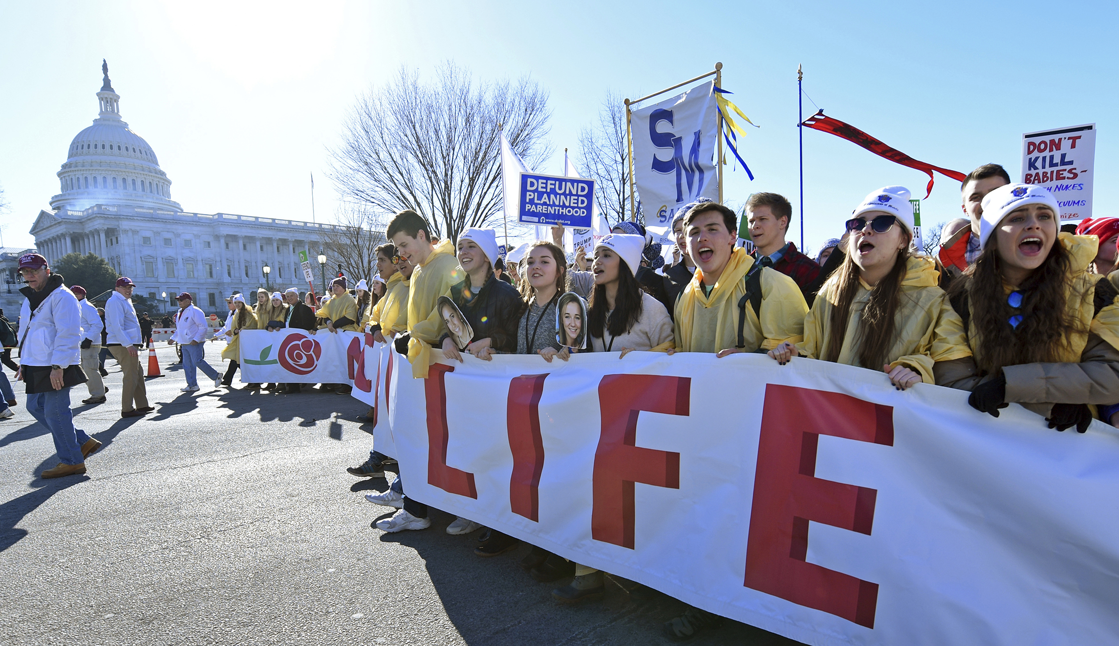 How to protect human life after conception