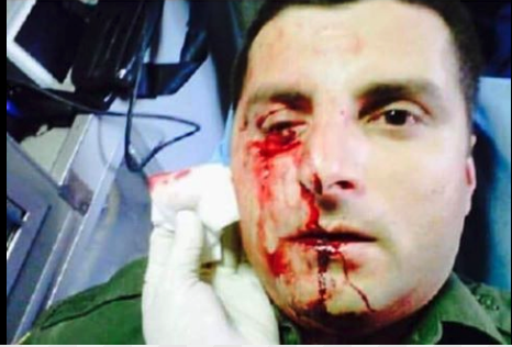 Fact Check: Does a Photo Show a Border Agent Attacked by the Current Migrant Caravan?