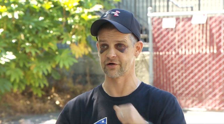 ‘I hit the ground’: Portland victim Adam Haner speaks out following brutal attack