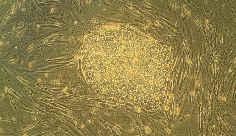 Helping patients without ending lives