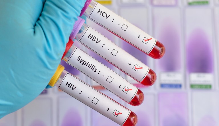 The sexually transmitted pandemic