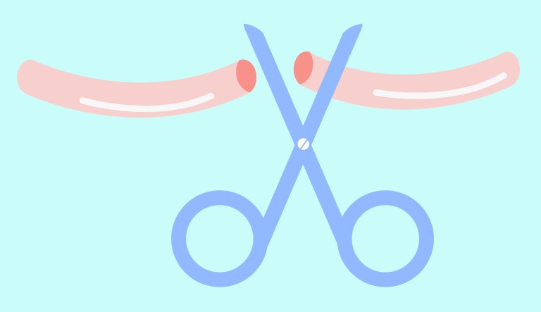 Want to support women? Get a vasectomy