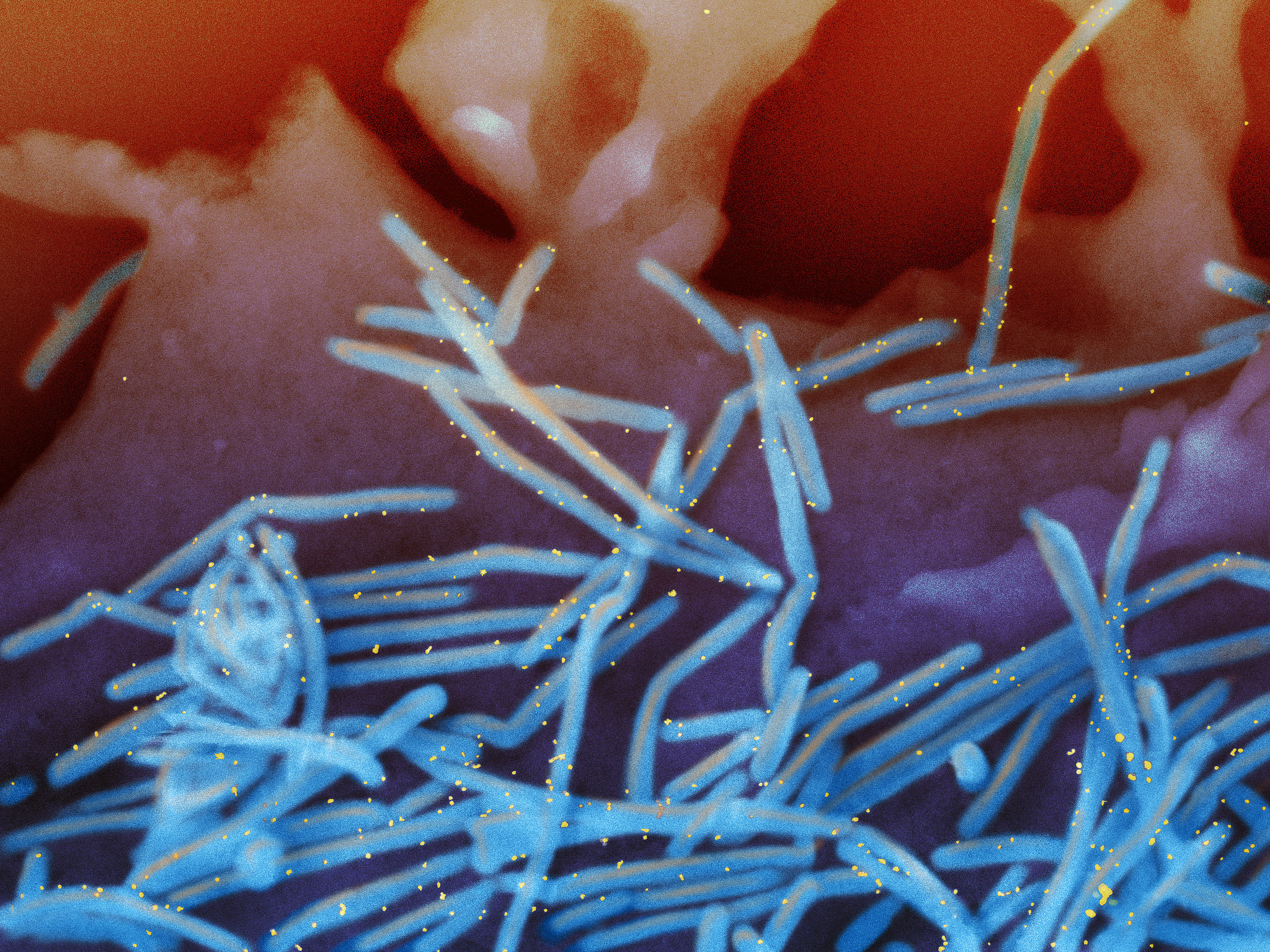 CDC warns of errors in RSV vaccines for infants and pregnant women