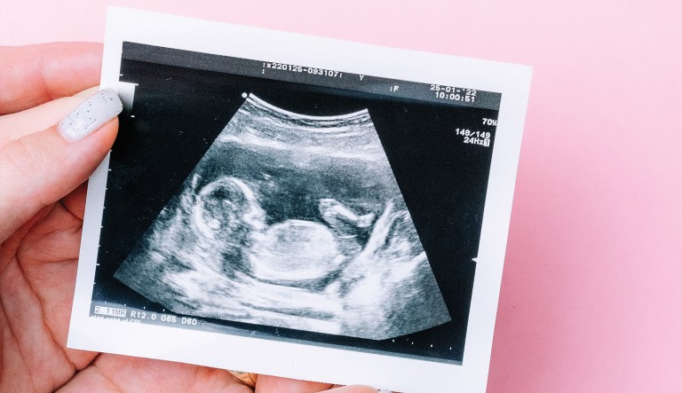 Roe’s remnants: The pro-life movement’s unfinished business