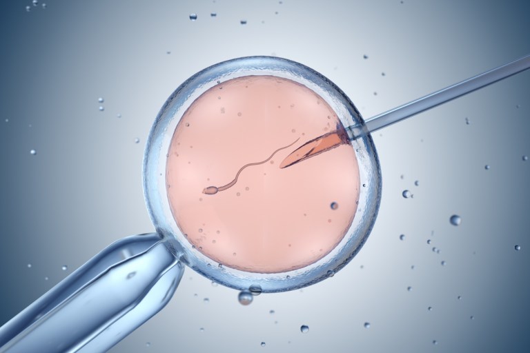 The IVF problem
