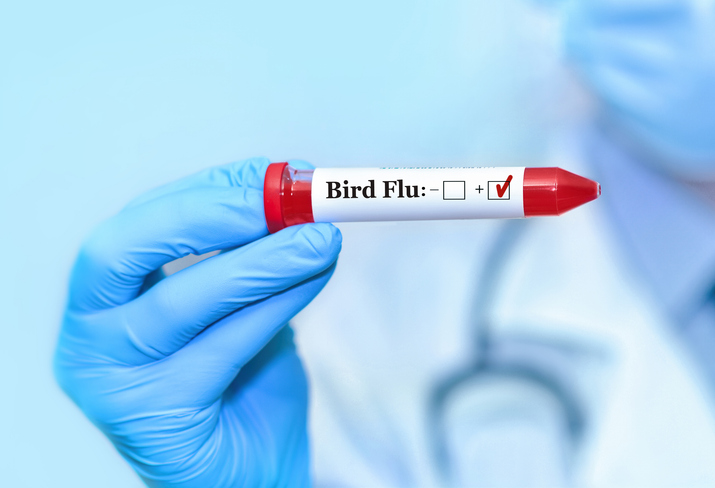 Bird flu detected in Arizona dairy’s milk supply