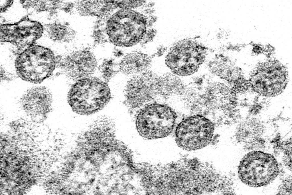 New COVID-19 origins paper from controversial scientists: What to know