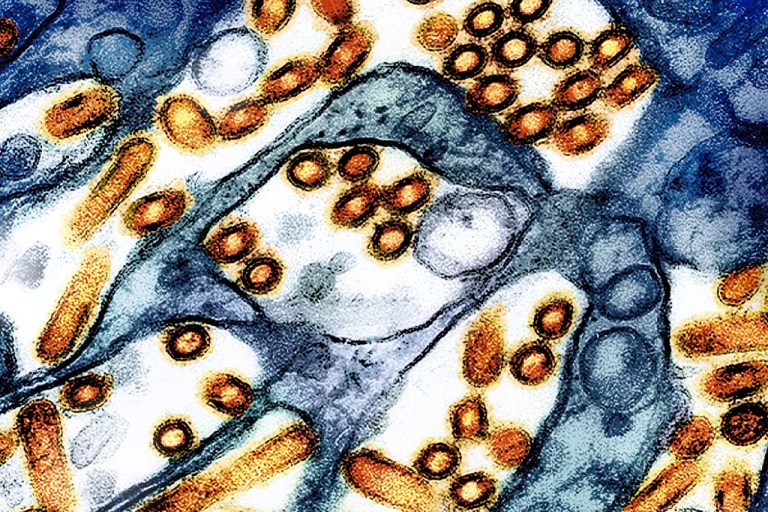 Avian influenza A virus particles under a microscope.