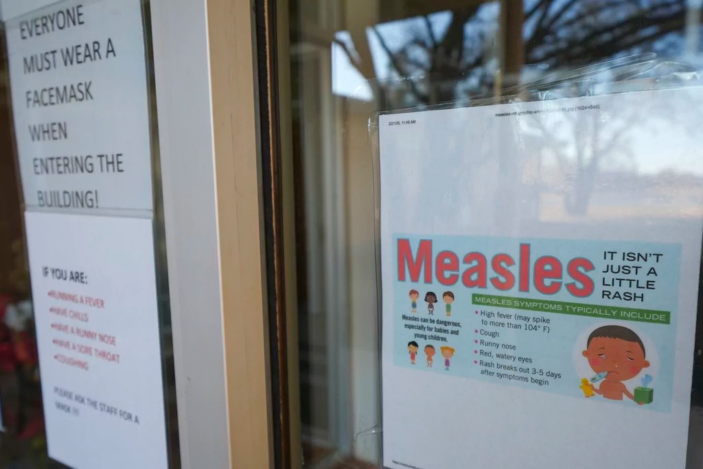 Texas measles cases rise to 146 in an outbreak that led to a child’s death