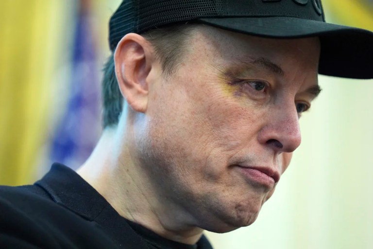 Elon Musk appeared with a small injury during his final press conference at the White House.