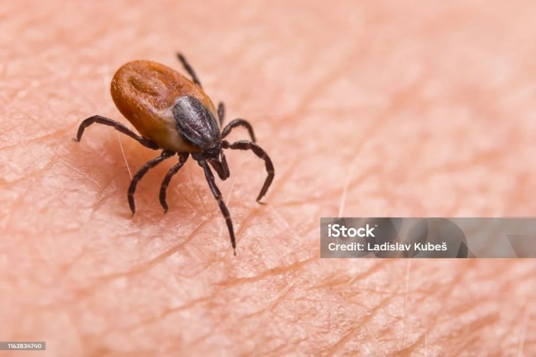 The race for a Lyme disease vaccine