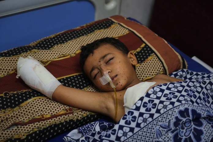 Yahya Shorbasi, who was injured by an unexploded ordnance, lies on a bed at Shifa Hospital.